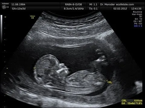 12 semanas de embarazo + ECOGRAFIA!♥ Embarazo y mucho mas - YouTube