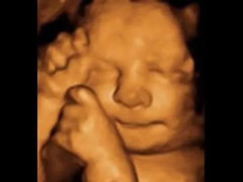 18 semanas eco en 3D,el sexo de mi bebé?!♥ Embarazo y mucho mas ...