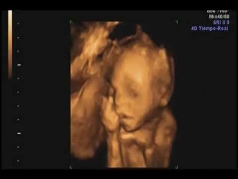21 semanas de embarazo de Mario Valentino - YouTube