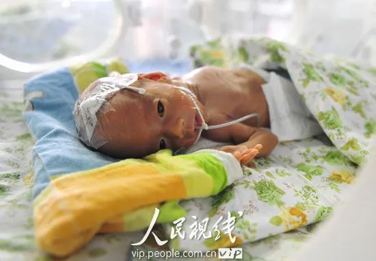 670-gram mini baby born in Hubei - People's Daily Online