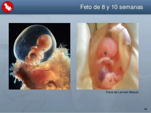Aborto. la cara oculta del aborto - Observatorio de Bioética UCV