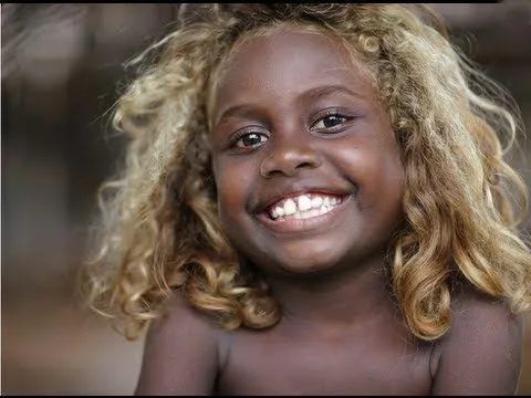 Nuestra Adopción, un embarazo diferente: NEGROS RUBIOS DE ISLA SALOMON Nuestra Adopción, un embarazo diferente: NEGROS RUBIOS DE ISLA SALOMON