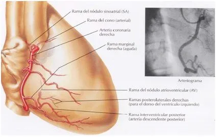Anatomía del Corazón: Vascularización del Corazón Anatomía del Corazón: Vascularización del Corazón