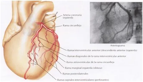Anatomía del Corazón: Vascularización del Corazón Anatomía del Corazón: Vascularización del Corazón