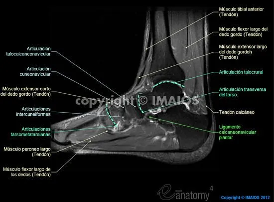 Anatomía del pie y el tobillo: IRM