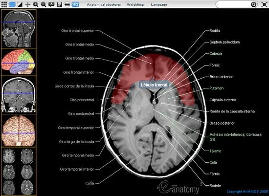 Anatomía de sección transversal del cerebro