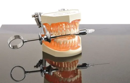 Anestesia dental con electroacupuntura | Blog del Especialista ...