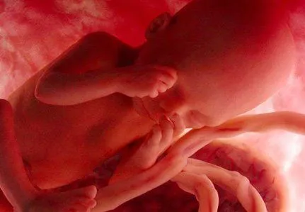 Bebés en el vientre de 5 meses - Imagui