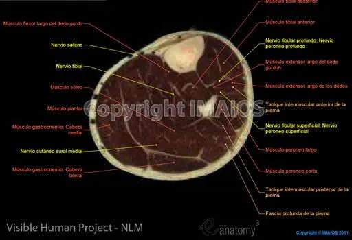 Atlas de anatomía humana : Visible Human Project (Pierna) Atlas de anatomía humana : Visible Human Project (Pierna)