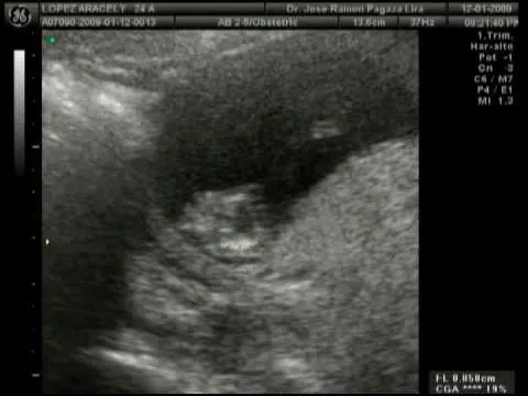 Mi bebe a 3 meses de embarazo, Ara y Roman - YouTube