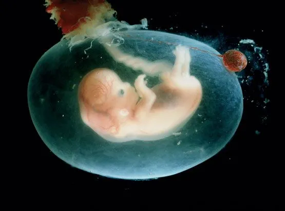 Imagen de un feto a los 2 meses - Imagui