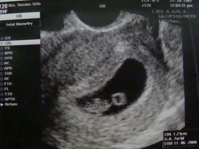 Nuestro bebe Precioso a las 7 semanas de Gestación | Flickr ...