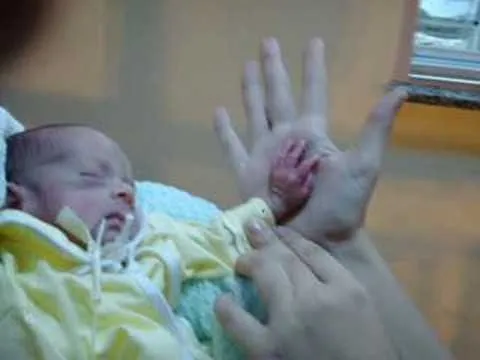 bebê prematuro - YouTube
