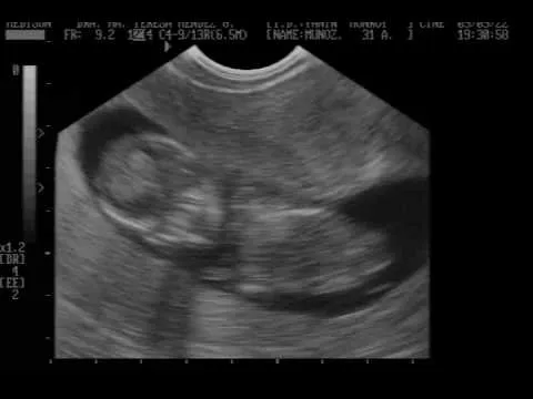 Nuestro Bebe Yanin & Gustavo 13 semanas de embarazo - YouTube