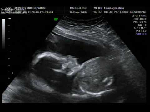 Bebe Yanin Gustavo 3D 21 Semanas de Embarazo - YouTube