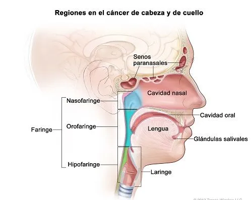 Cáncer de cabeza y cuello - Infoteca Salud