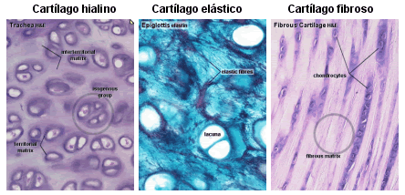 El cartílago - tejido cartilaginoso - Escuelapedia - Recursos ... El cartílago - tejido cartilaginoso - Escuelapedia - Recursos ...