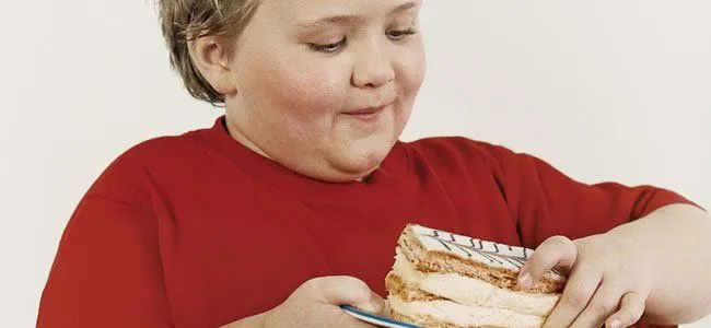 Causas de la obesidad infantil.