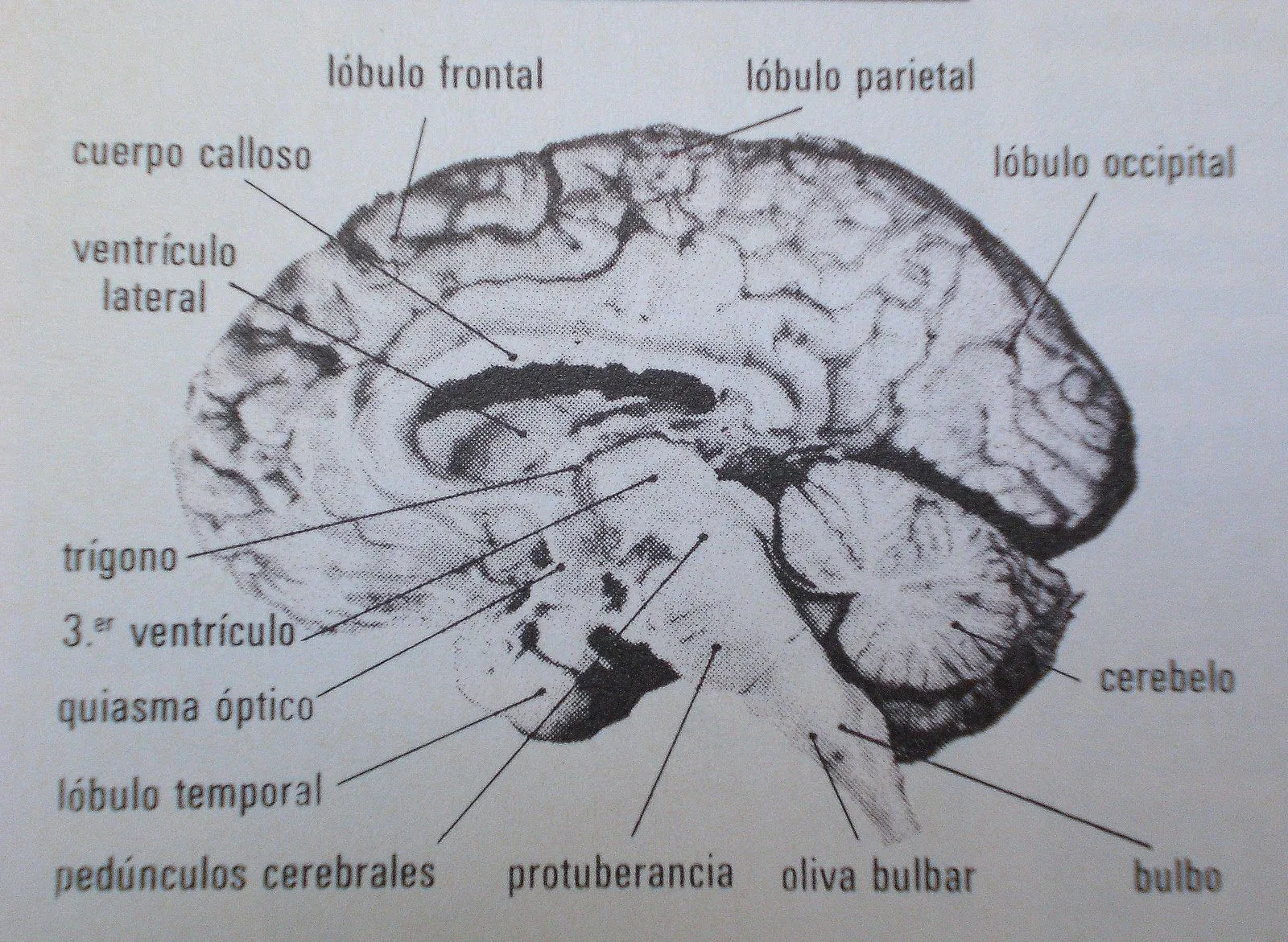  ... pintura se hallaría representado el hemisferio derecho del cerebro