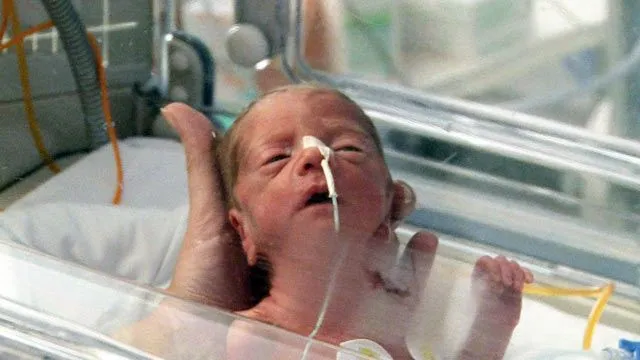 Comando actualidad - Milagro médico - Bebés prematuros, Comando ...