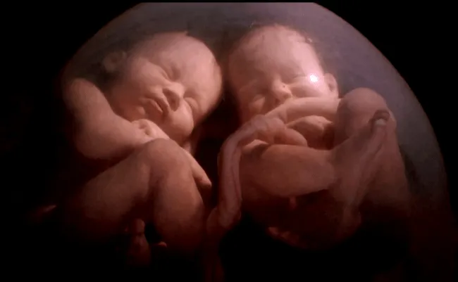 En el vientre materno: gemelos idénticos": el documental sobre el ...