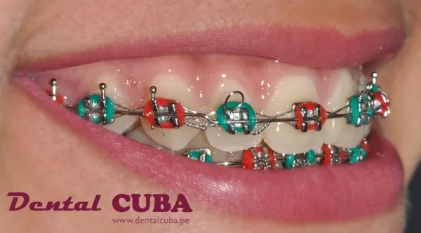Dental Cuba - Consejos