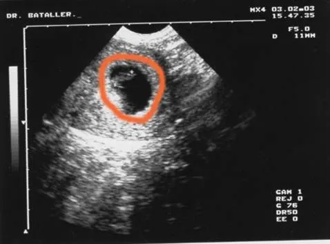 Desarrollo embrionario: desde el cigoto hasta el recién nacido ...