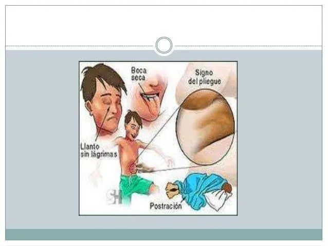 Diarrea aguda infecciosaamzl 2011 Diarrea aguda infecciosaamzl 2011