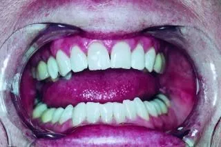 dientes, la boca, los dientes | Descargar Fotos gratis