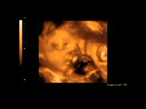 Ecografia 3D 4D - 27 semanas 5 días de embarazo - YouTube