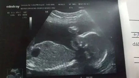 ecografia de mi bebe - ❤ Bebés de Noviembre 2014 ❤ - BabyCenter
