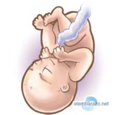 Embarazo multiple en el vientre materno | Artículos útiles sobre ...