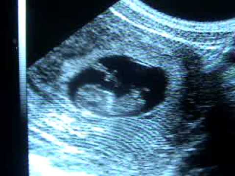 Embarazo de 9 semanas - Pregnancy 9 weeks - YouTube