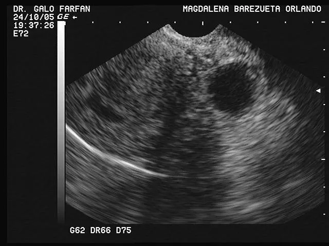 embriologiacatedragalofarfanjaime: noviembre 2010