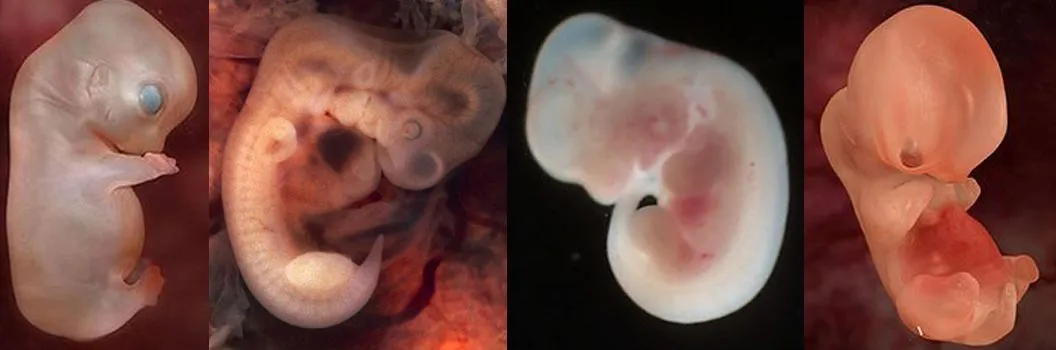 Sobre embriones, fetos y bebes | Tall & Cute
