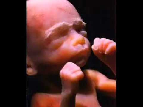 ETAPAS DEL EMBARAZO.....STAGES OF PREGNANCY......... - YouTube