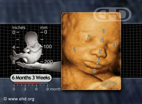 face-27-week-fetus.jpg