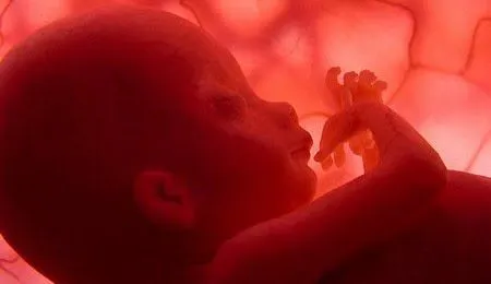 feto de 5 meses cuyo asesinato ya es legal