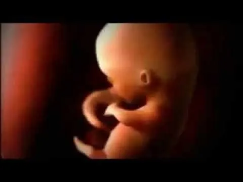 Formacion del bebe (Milagro de Dios) - YouTube