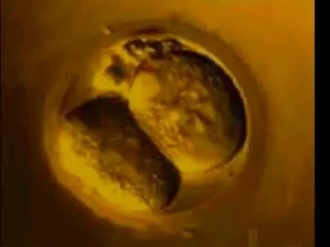 Formación de bebé - Imagui