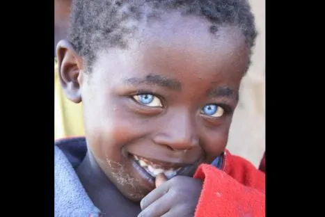 FOTOS: Conoce al niño africano de los ojos de zafiro - Radio ...
