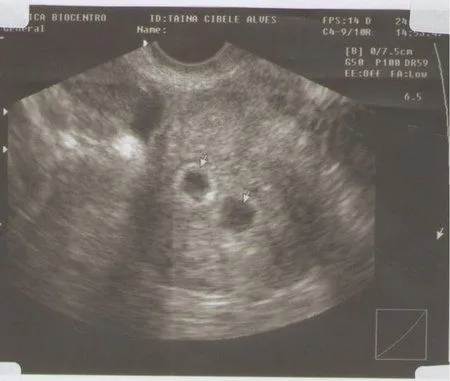 gêmeos de 5 semanas - Gêmeos, trigêmeos ou mais - BabyCenter