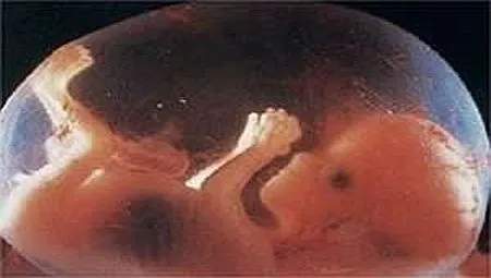 Gestação Bebê – Gestação de 3 meses – Fotos, Sintomas, imagens