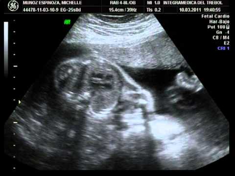 2ª Ecografía de mi bebé, 24 semanas de gestación - YouTube