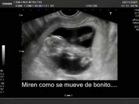 Embarazo de 4 meses de gestacion fotos - Imagui