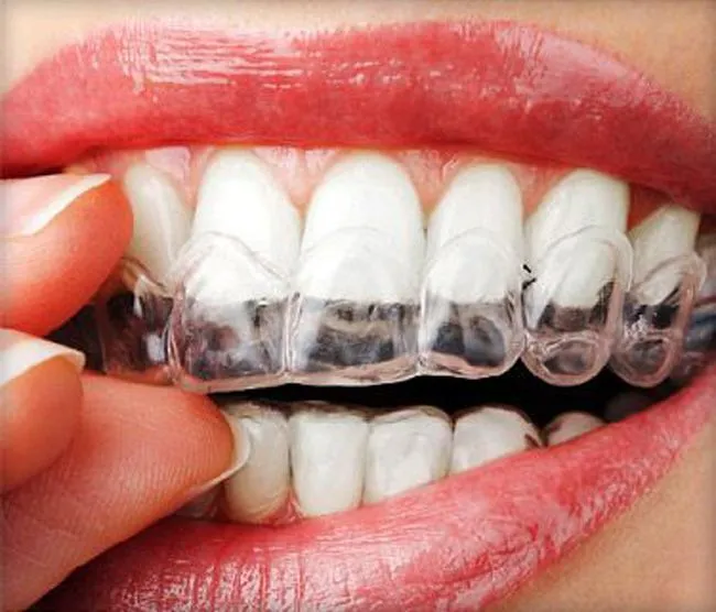 Reconoces estos 10 mitos falsos sobre la ortodoncia? - Clínica ...