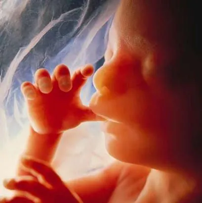  ... imagenes muy duras sobre ninos abortados que han cambiado la forma