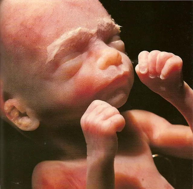 Imágenes edad gestacional | Aborto. La información médica