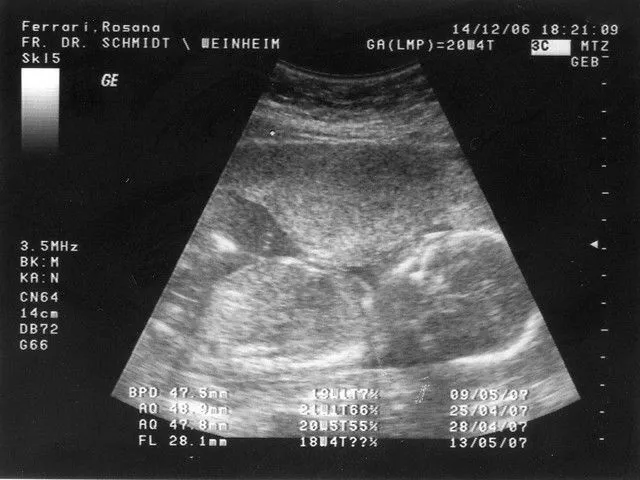 Ultrasonido, 14 de dic. en menos de 4 meses nazco | Flickr - Photo ...