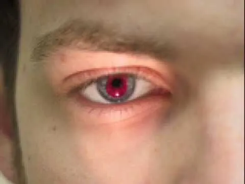lentes de contacto coloreadas rojas para Discromatopsia y ...